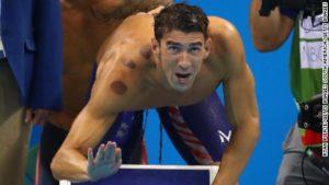 160809172558-michael-phelps-cupping-large-169